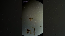 Thumbnail for Cell Explodes Under Microscope (Hydrogen Peroxide vs Germs) | CloseIntel