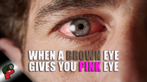 Thumbnail for When a Brown Eye Gives You Pink Eye | Grunt Speak Shorts