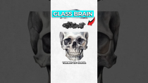 Thumbnail for Archaeologists Discover Glass Brain | Dr Ben Miles