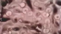 Thumbnail for ABSOLUTE PROOF FLUORIDE KILLS! - Footage of fluoride damaging cells and stopping reproduction