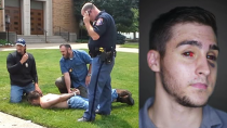 Thumbnail for Officers Nearly Beat Innocent College Student to Death—Then Claim Immunity from All Accountability