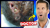 Thumbnail for The Most Disturbing Parasites Found Inside Humans | Doctor ER