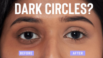 Thumbnail for Home remedies to remove dark circles QUICKLY and NATURALLY! | Glamrs by Purplle