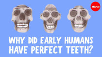 Thumbnail for Why do we have crooked teeth when our ancestors didn’t? - G. Richard Scott | TED-Ed