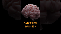 Thumbnail for This is the REAL reason headaches hurt | Be Smart