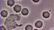 Thumbnail for Neutrophil Chases and Eats aStaphylococcus aureus Bacterium