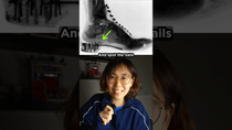 Thumbnail for Why Did Kids Put Their Feet in X-Ray Machines? | vt.physics