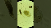 Thumbnail for Dileptus Cell Attacks Stentor Cell Under Microscope | CloseIntel