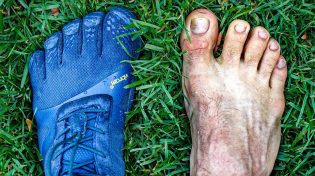 Thumbnail for 2 Years in Barefoot Shoes... My Feet Aren't The Same! | Mike Hanna