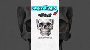 Thumbnail for Archaeologists Discover Glass Brain | Dr Ben Miles