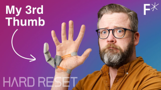 Thumbnail for Bionic 3rd thumb: The future of human augmentation | Hard Reset | Freethink