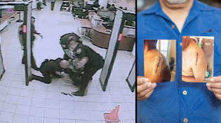 Thumbnail for Vietnam Vet Beaten by Police in Unprovoked Assault at VA Hospital