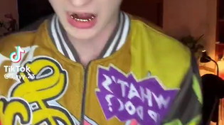 Thumbnail for AIDS