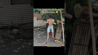 Thumbnail for This Condition Looks Extremely Painful… 😔 #interesting | IdkSterling