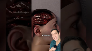 Thumbnail for Doctor Reacts: cell phones cause cancer?! | Doctor Myro
