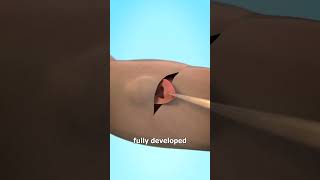 Thumbnail for Growing An Ear In Your Arm 😨 | Zack D. Films