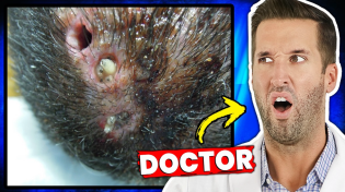 Thumbnail for The Most Disturbing Parasites Found Inside Humans | Doctor ER