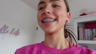 Thumbnail for ✨🌈Braces R Beautiful! 🌈✨ (Episode 9) | Braces "R" Beautiful!