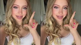 Thumbnail for ✨🌈Braces R Beautiful! 🌈✨ (Episode 41) | Braces "R" Beautiful!