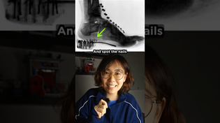 Thumbnail for Why Did Kids Put Their Feet in X-Ray Machines? | vt.physics