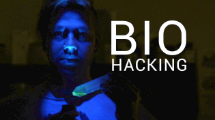 Thumbnail for DIY Biohacking Can Change The World, If the Government Allows It
